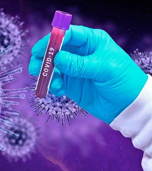 covid-19-coronavirus
